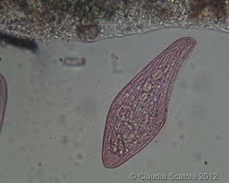 Ciliato (Blepharisma sp)